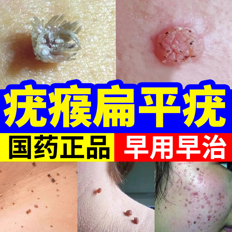 【韩都】维A酸乳膏0.1%*15g*1支/盒
