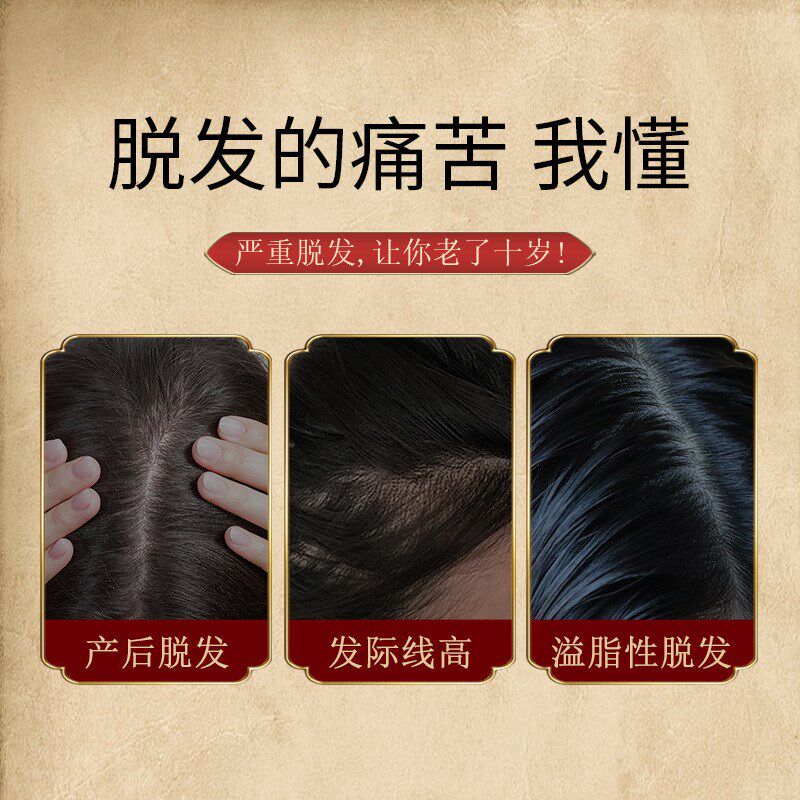 防脱发生发育发液头发增长液增发密发固发止脱男女脂溢性产后脱发