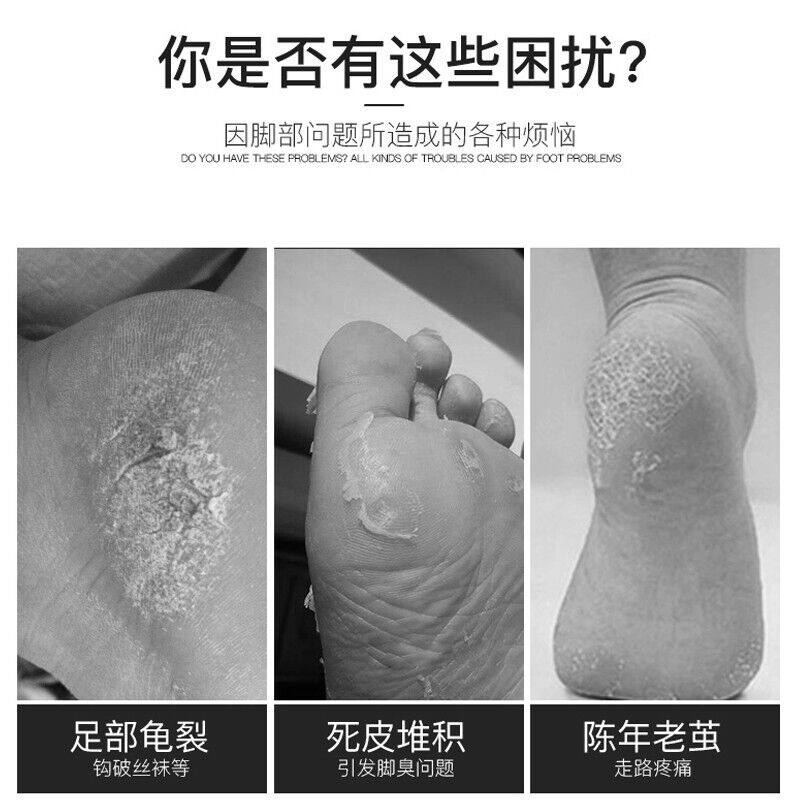 好货多功能充电式电动修脚器修足机磨脚石磨脚器去死皮搓老茧工具