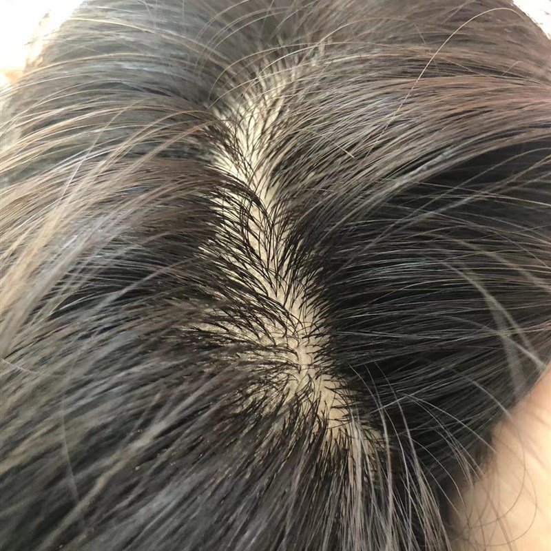 男士假发全递针男短发头顶补发片真发无痕点扣生物头皮补发双递针