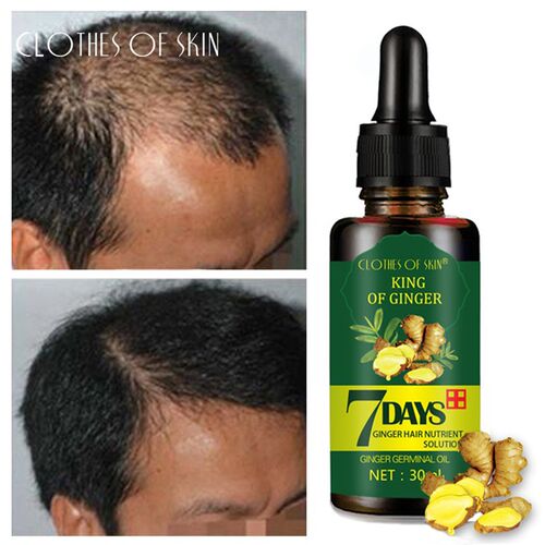 极速7 Days Ginger Essence Hair Essential Oil Hair Care Oil H