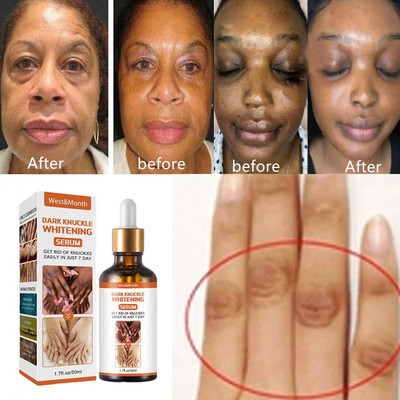 Efficient Whitening Armpit Knuckle Knee Black skin oil精华液