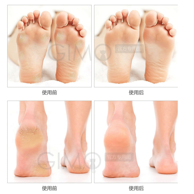 电动磨脚器去死皮老茧修脚神器家用修足机美甲店专用工具修脚器