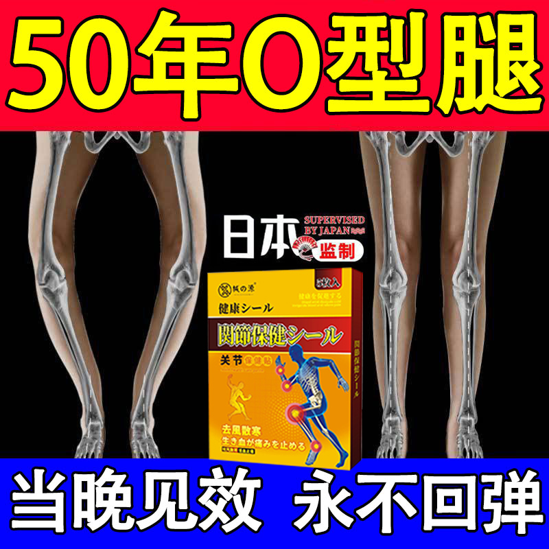 新品O型腿矫正神器膝内翻小腿外翻矫正器罗圈腿内八矫正腿型直腿