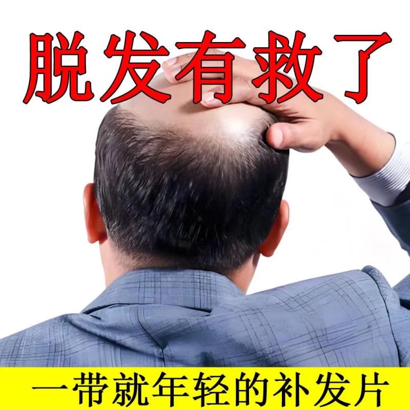 假发男短发自然全真发无痕隐形假发片男士头顶补发片真人刘海发丝
