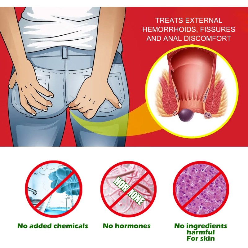 Herbal Hemorrhoids spray relieves anal Fissure Pain itching
