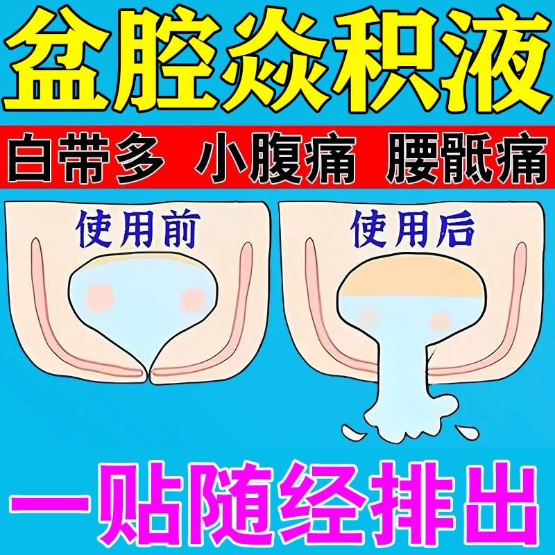 速发盆腔积液的药卵输管堵塞贴膏月经失调宫腔黏连盆腔消炎热敷包