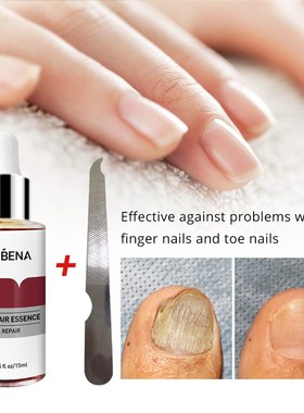 Lanbena prego repara??o essncia soro fungo remo??o unh