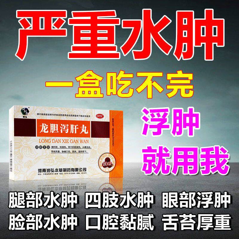 消水肿去水肿治身体浮肿腿肿脚肿脸肿排水肿四肢水肿 龙胆泻肝丸