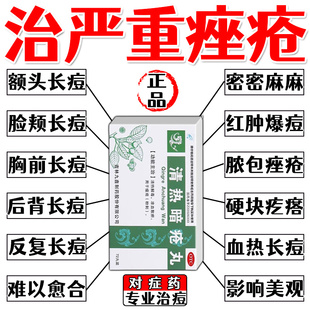 严重痤疮药满脸是痘粉刺痘痘脓包硬疙瘩红肿疼痛瘩胸前后背痘