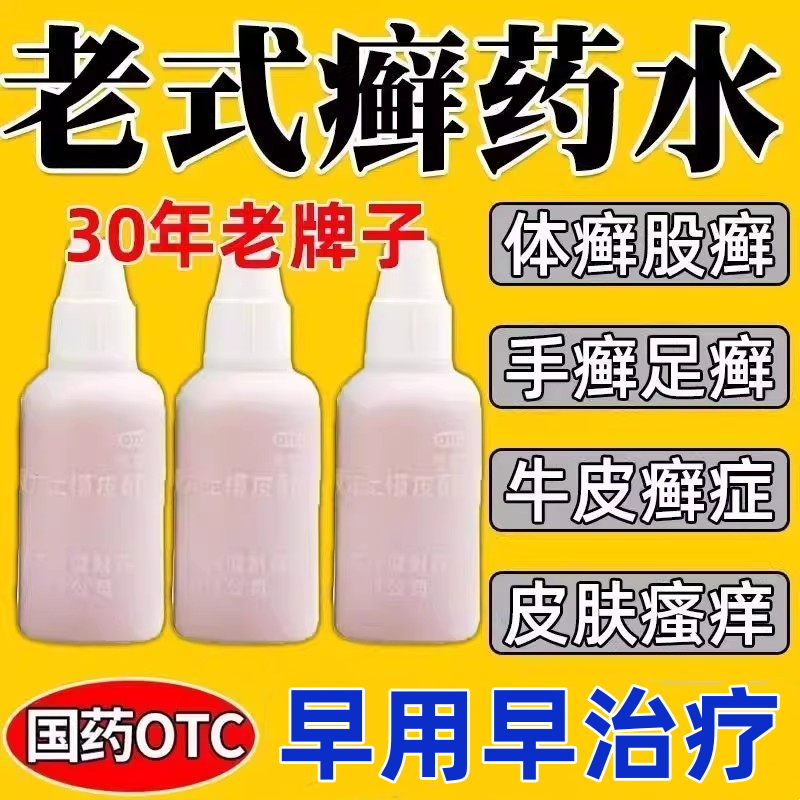 老式癣药水复方土槿皮酊皮肤癣药水止痒皮肤瘙痒止痒抑菌全身外用