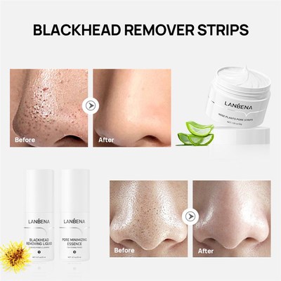Face Blackheads Remover Peel Off Black Dots Mask Skin Care P