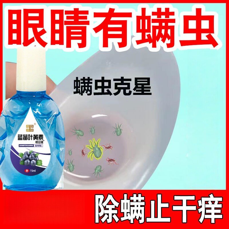 治眼睛螨虫洗眼液干痒杀除螨湿巾清洁眼水眼贴眼睑滴眼部专用