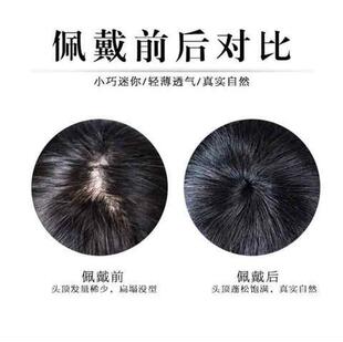 刘海儿假发全假发假发片一片式头顶补发片无痕蓬松遮白发迷你头