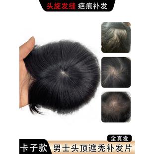 假发片男全真人发头旋发缝男士补发遮盖伤疤头顶部稀少脱发补发片