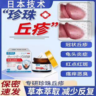 龟头炎症冠状沟珍珠疹去除专用系带旁丘疹颗粒皮脂腺异位症膏X