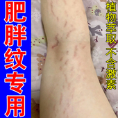 肥胖纹专用修复霜大腿腰腹上生长纹青少年学上男女淡化红白色纹路