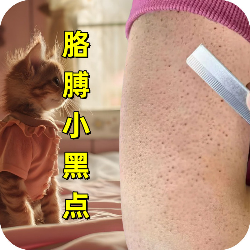 胳膊红点皮毛周角化皮肤粗糙颗粒身体乳/霜
