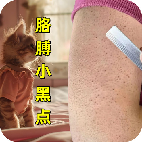 胳膊红点皮毛周角化皮肤粗糙颗粒毛囊角质堵塞去皮肤专用