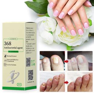 20ML Nail Repair Solution Lotion Foot Fungal atment Serum Ha