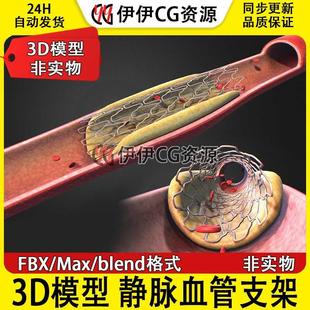 3D模型3Dmax医学模型静脉血管支架心脏血管疏通球囊扩张搭桥手术