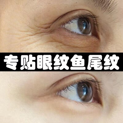 极速【一贴去眼纹】祛除眼角纹淡化细纹眼纹消鱼尾纹神器眼贴抗皱