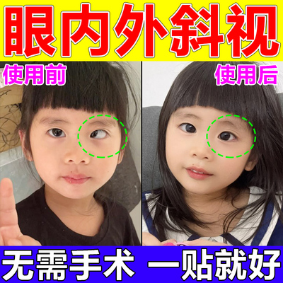 斜视矫正器训练器聚散球纠正儿童对眼成人内外斜视弱视斗鸡眼斜贴