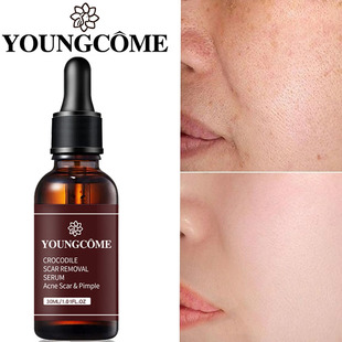 Removal Wrinkle Fade Anti Fine Lift Aging Firm Retinol Serum