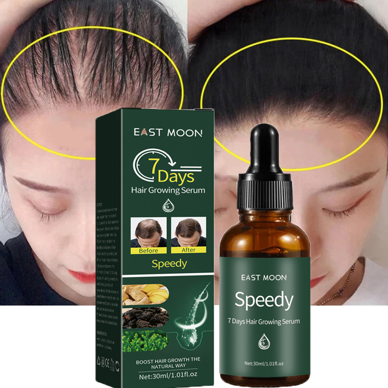 7 Days Ginger Hair Growth Products Fast Growing Hair Essenti