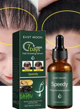 7 Days Ginger Hair Growth Products Fast Growing Hair Essenti