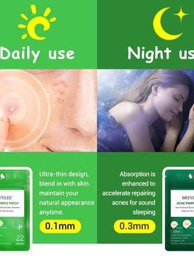 极速Acne Pimple Patch  Stickers Acne Treatment Pimple Remove