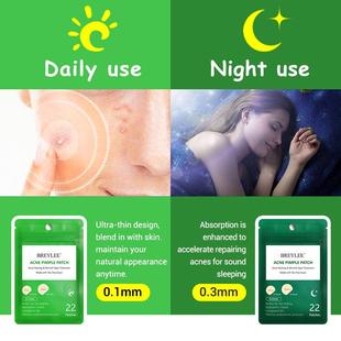 Treatment 极速Acne Remove Acne Stickers Pimple Patch