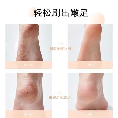 极速阿本果酸 霜修复滋润去角质死皮足膜嫩足霜护脚膏嫩足刷刷棒