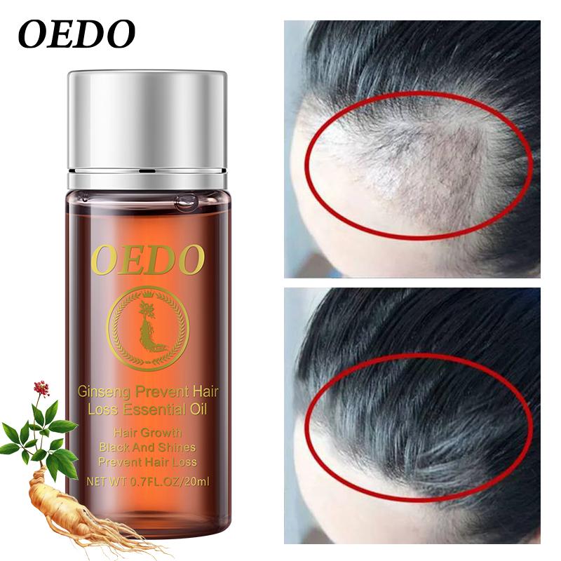 Ginseng fortalecer o reparo do leo essencial do cabelo dan