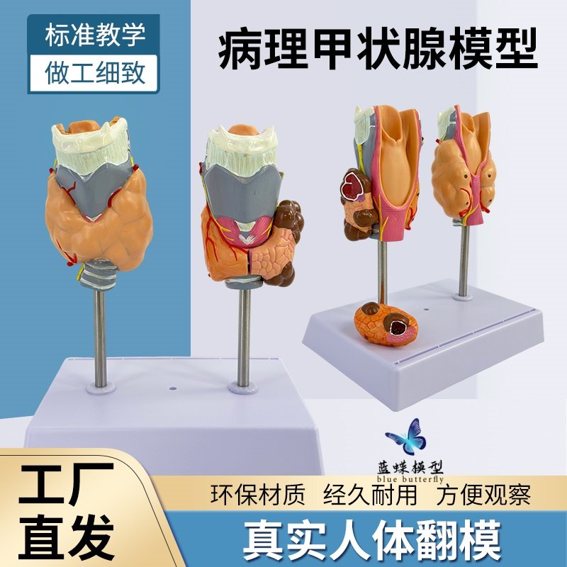 蓝蝶模型人体病理甲状腺教具