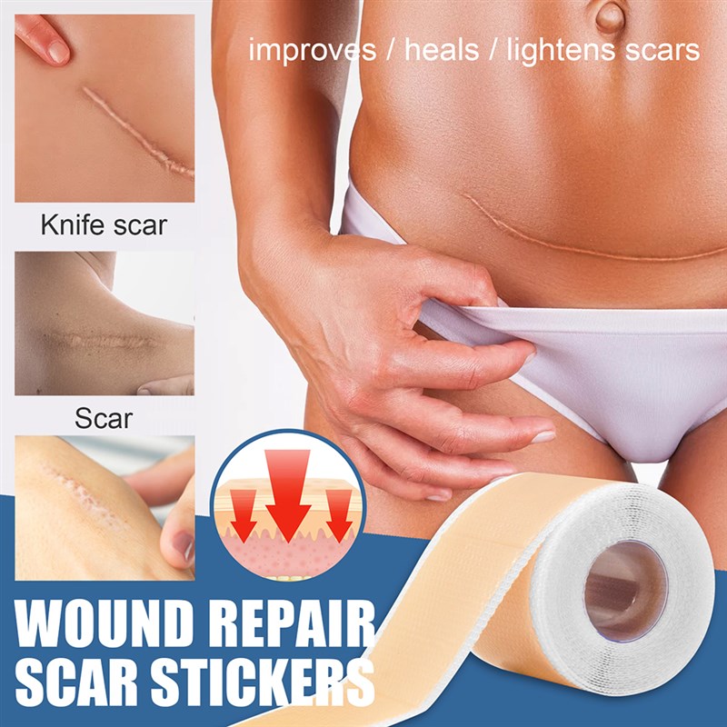 极速150cm Silicone Scar Sheets Adjustable Gel Patches Remova