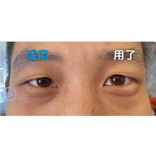新『Mina高奢』全家自用冰美式~万neng眼油（每次用之前要摇匀）