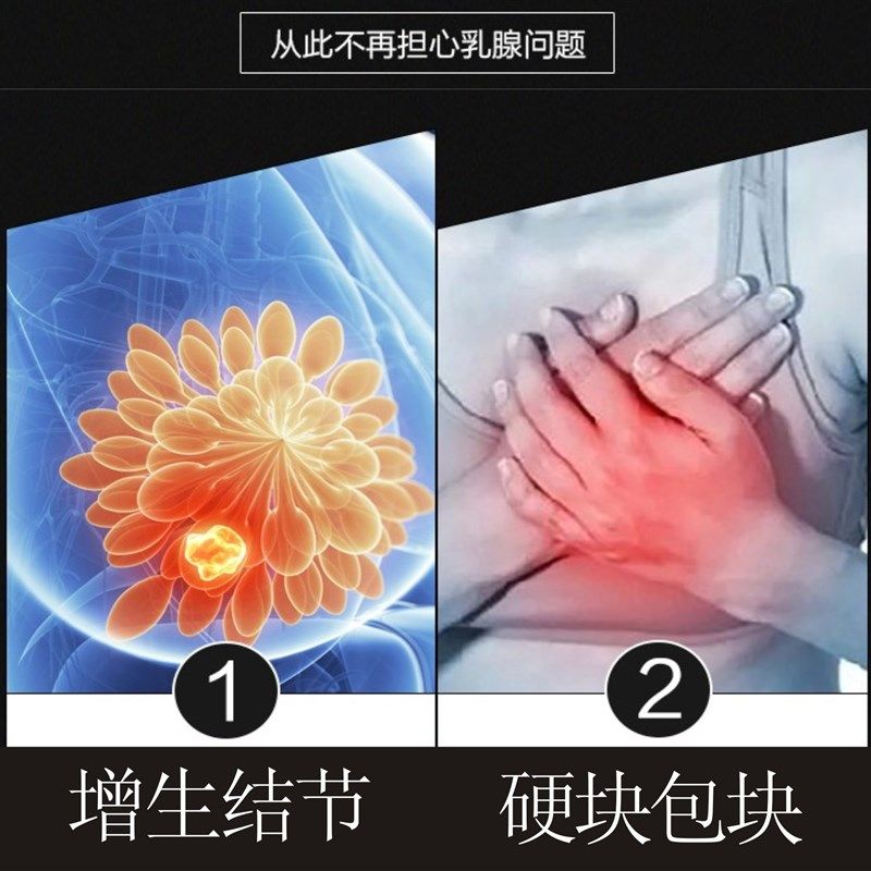 安和牌乳腺贴块散结贴结节疏通安康奶增生乳消贴五盒装