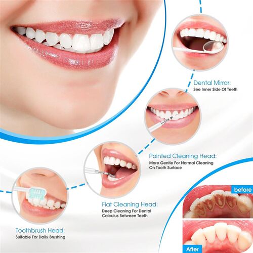 极速Electric Dental Calculus Remover Teeth Cleaning Device T