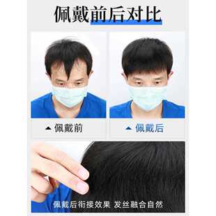 新款直销男士m型发际线假发贴刘海假发片一片式男生前额全真发蓬