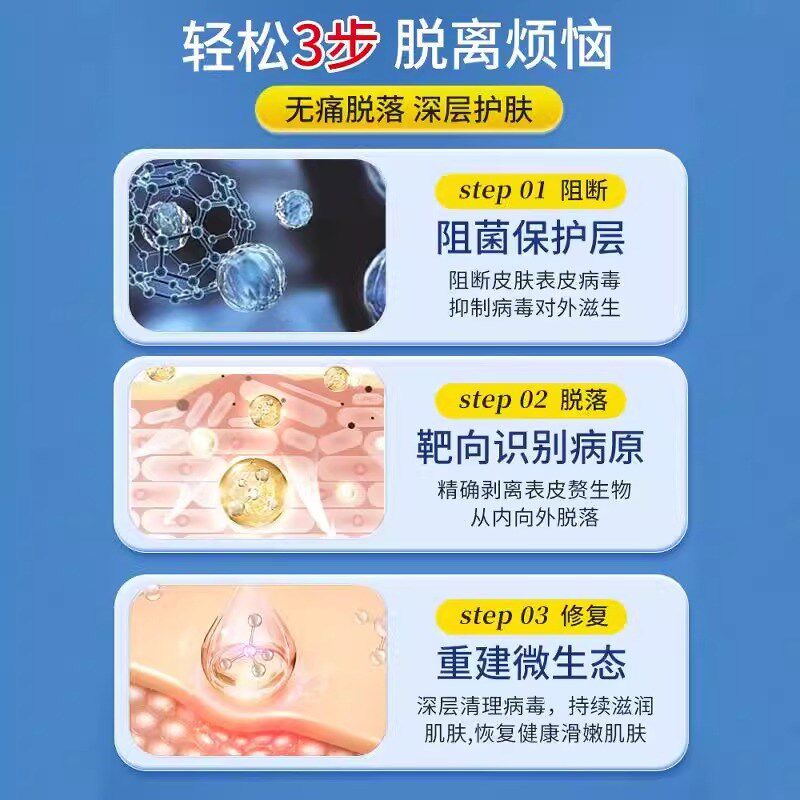 热销跖疣专用膏去除祛寻常疣病毒疣瘊净扁平疣鸡眼膏足部脚趾跖疣