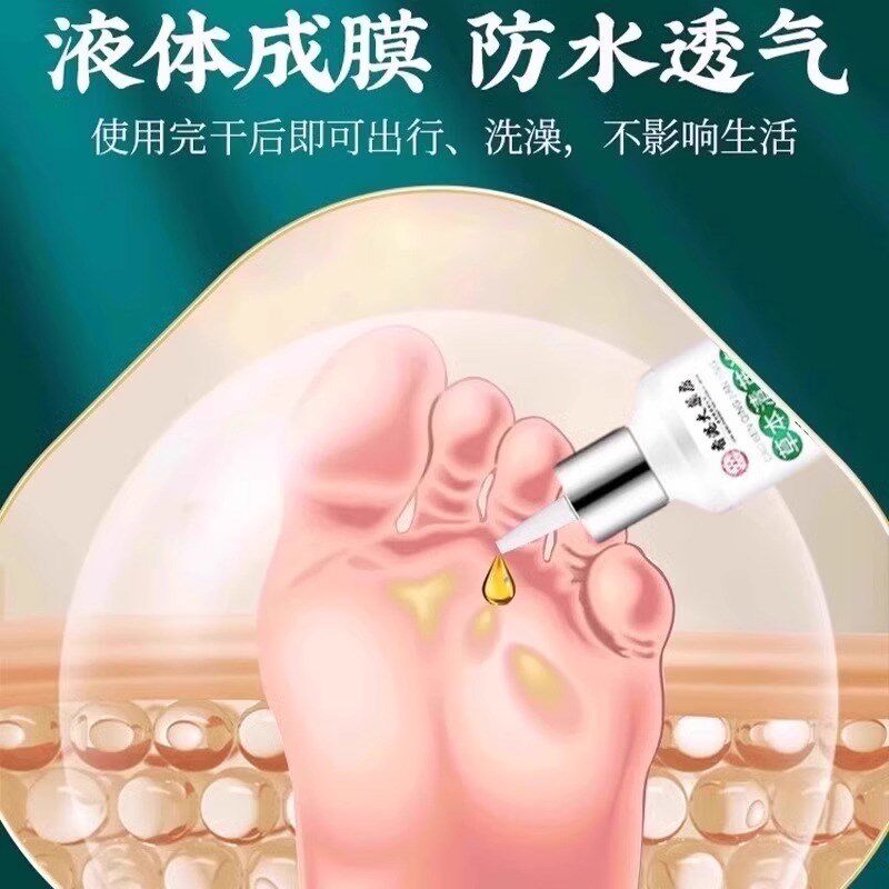 热销老茧去除剂软化手脚上脚趾脚底死皮厚皮脚垫鸡眼无痛自然脱落