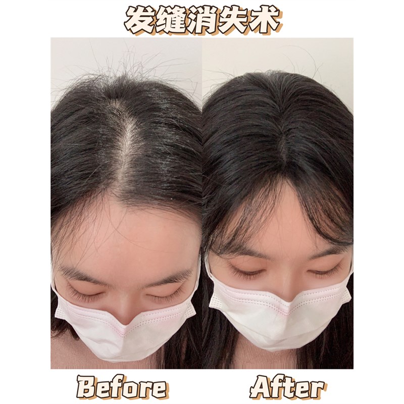 邻家妹宝黑色假刘海八字刘海假发片头顶颅顶补发片女自然遮白发