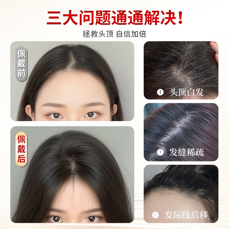 假发女片头顶补发蓬松真发遮头顶白发增发量高颅顶无痕轻薄假发片