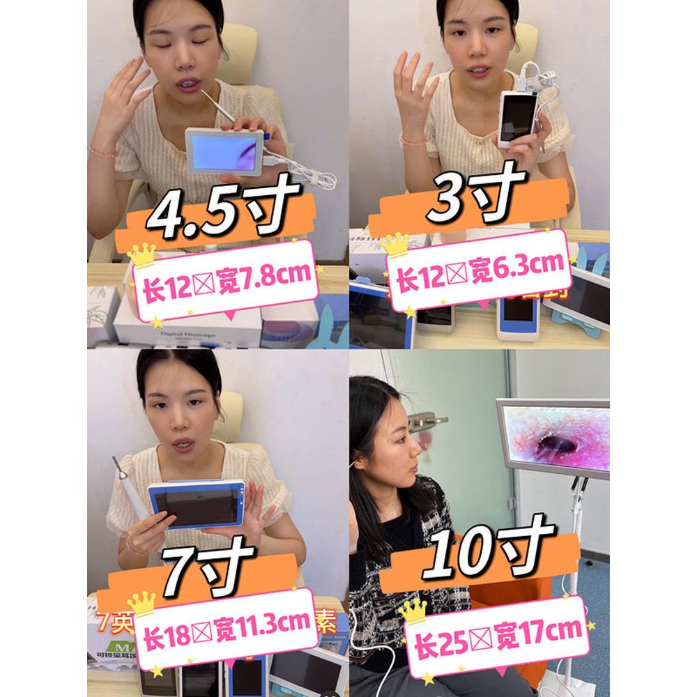 可视挖耳勺掏耳朵专业高清耳道鼻腔内窥镜采耳仪器耳镜超细开店