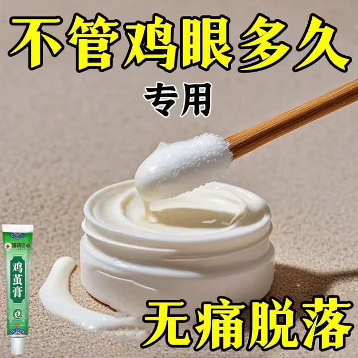 鸡眼软膏鸡贴眼跖尢肉刺关节茧去除软膏去老茧鸡眼神器官方正品