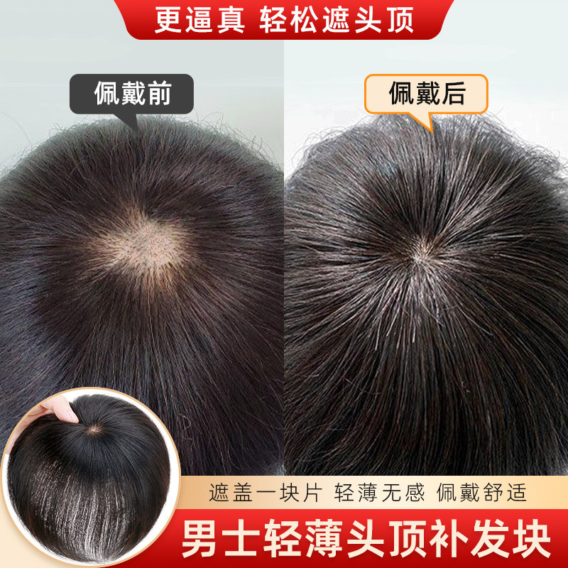 真人头发头旋补发片 男士女士增发蓬松假发块 生物头皮自然黑款