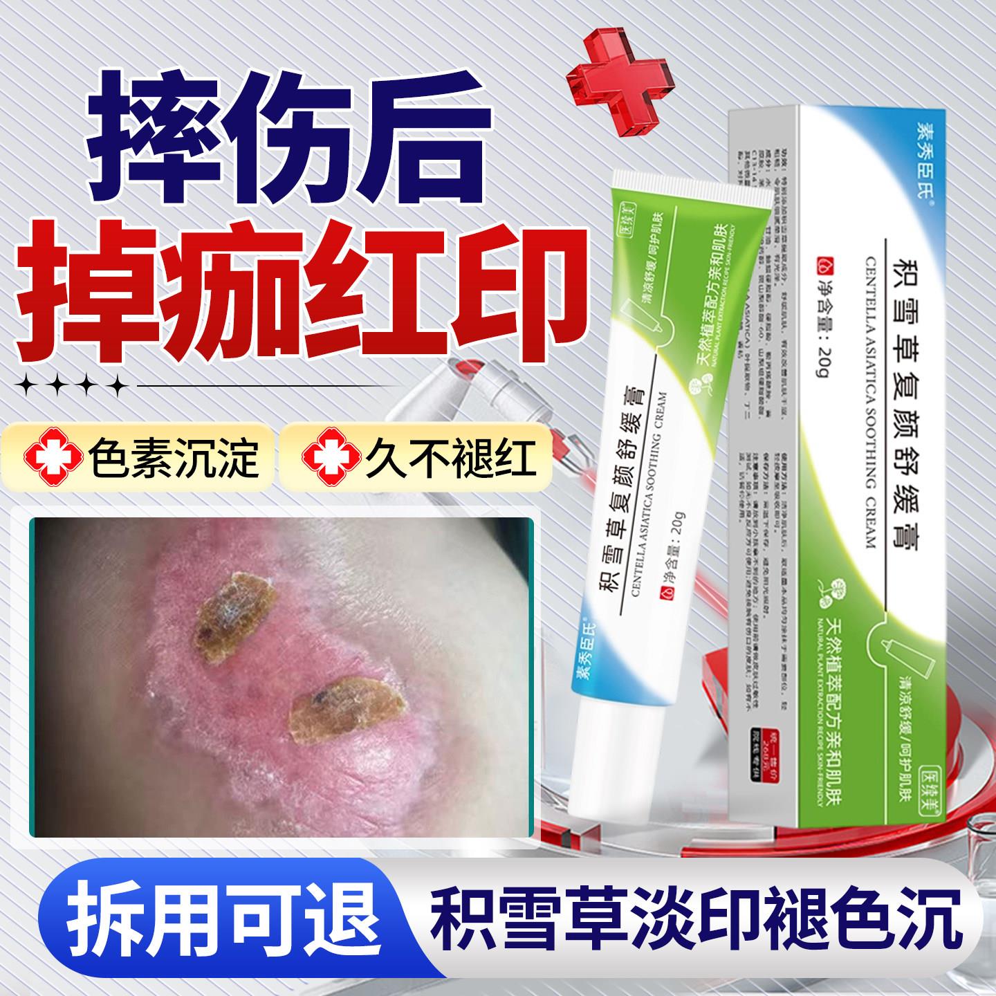 摔伤擦伤结痂掉痂后留红印去疤痕修复除疤膏黑色素沉淀去儿童QQ图片