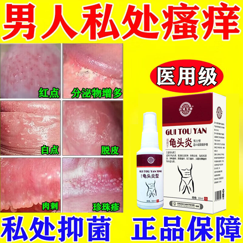 小红点疙瘩真菌感染潮湿瘙痒红肿