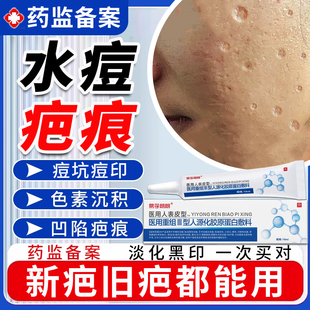 水痘疤痕修复膏去水痘坑痘印凹陷性疤痕生长因子凝胶点痣祛疤膏JY